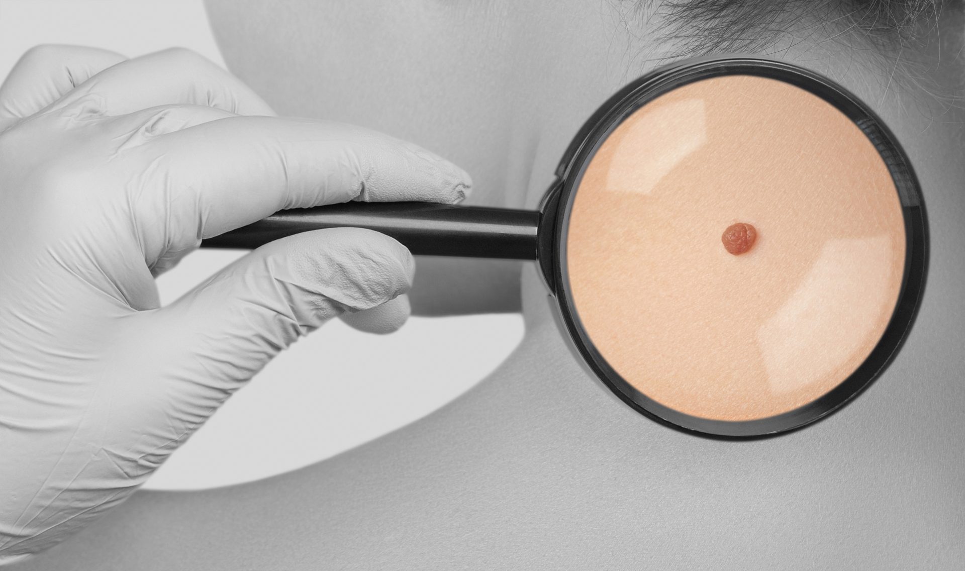 Dermamedizin dermatologie